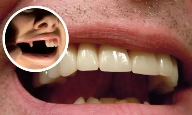 Révolution dentaire : la possibilité de faire repousser vos dents devient réalité