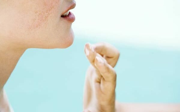 Traiter naturellement l’acné estivale : conseils et produits